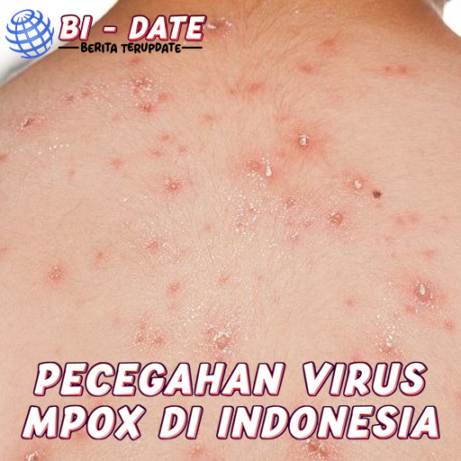 Pencegahan Mpox